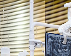 Things You Must Know Before Implant Surgery image 14