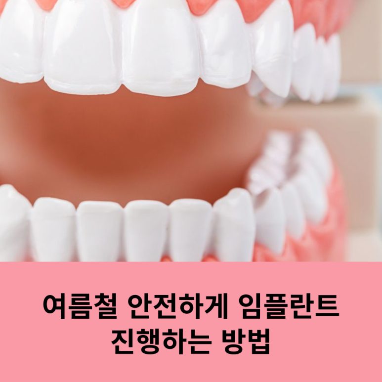 How to Safely Get Dental Implants in Summer image 10
