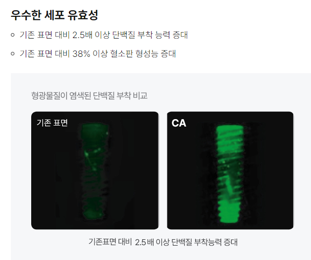 석플란트에서 오스템임플란트 궁금증 해결 관련 이미지 7