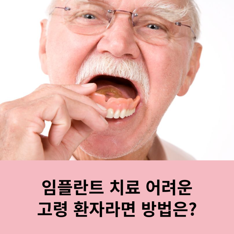 임플란트 치료 어려운 고령 환자라면 방법은? 관련 이미지 10