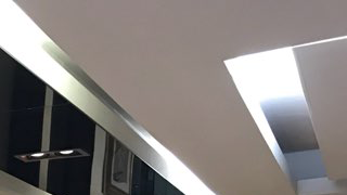 임플란트 치료기간에는 세심한 관리 필요 관련 이미지 13