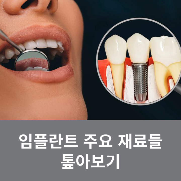 임플란트 주요 재료들 톺아보기 관련 이미지 5