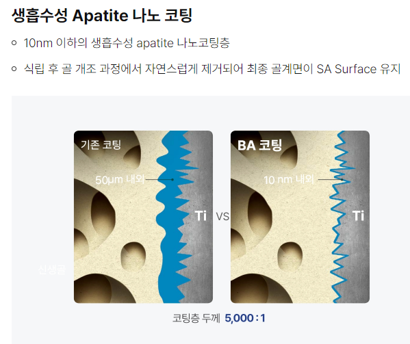 석플란트에서 오스템임플란트 궁금증 해결 관련 이미지 8