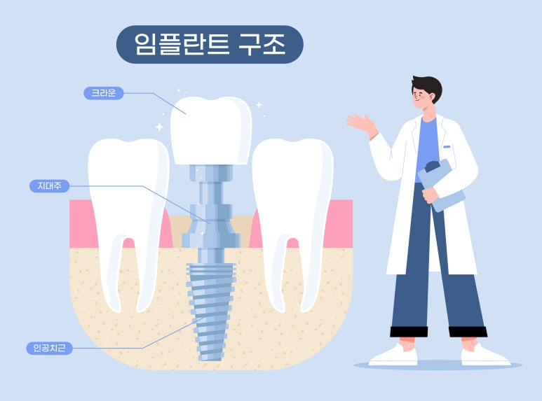 Let’s Learn About Bone Graft Implants image 5