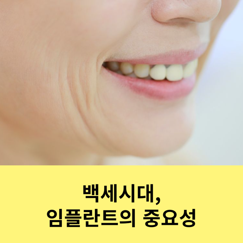 The Age of 100 Years: The Importance of Implants image 9