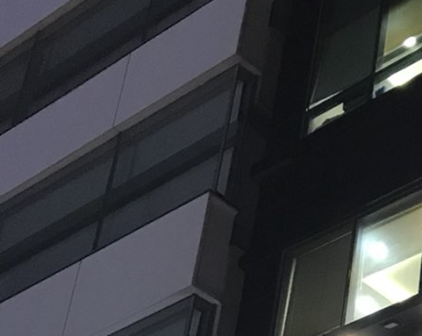 이가 빠졌을때, 임플란트 하세요 관련 이미지 14