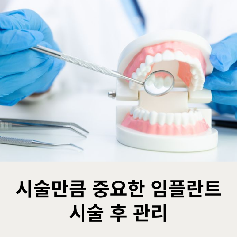 Post-Procedure Care for Implants Is as Important as the Procedure Itself image 8