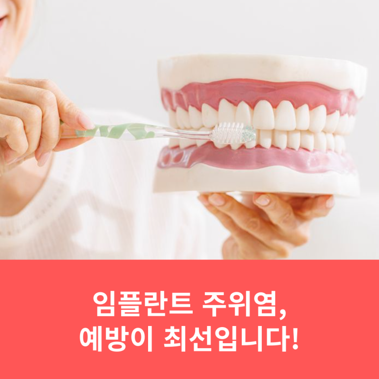 임플란트 주위염, 예방이 최선입니다! 관련 이미지 10
