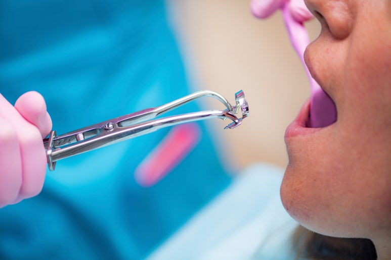 Prosthodontic Treatment: What You’re Curious About! Part 1 image 1