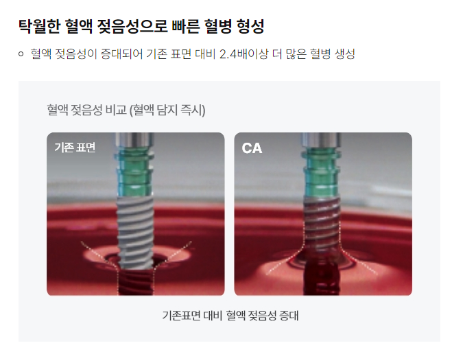 석플란트에서 오스템임플란트 궁금증 해결 관련 이미지 6