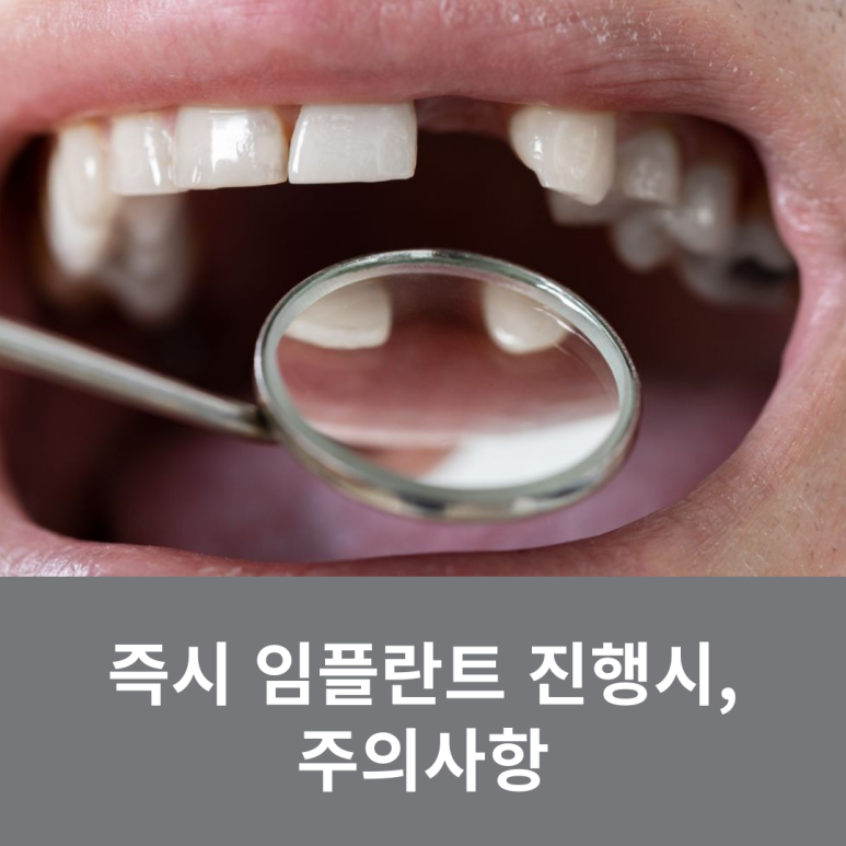 즉시 임플란트 진행시, 주의사항 관련 이미지 8