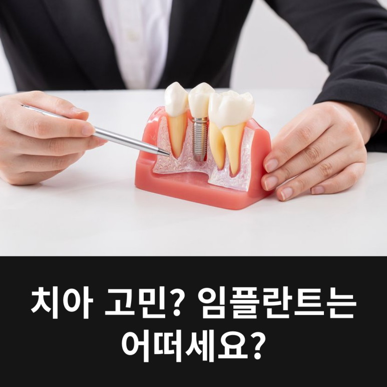 Teeth Problems? How About Implants? image 7