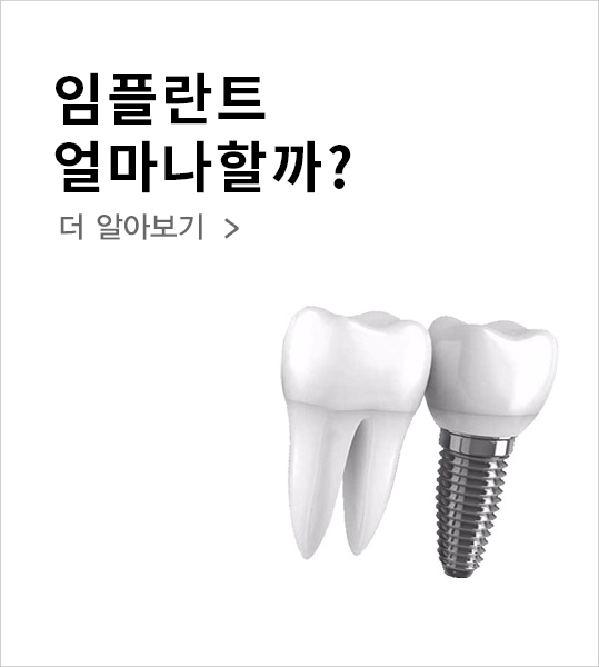Before Starting an Implant, Be Sure to Know This! Implant Information - Seokplant Dental Hospital image 5
