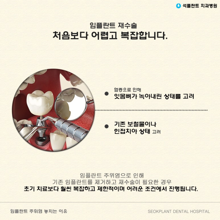 강남 석플란트 치과병원 임플란트 주위염 예방하려면? 관련 이미지 4