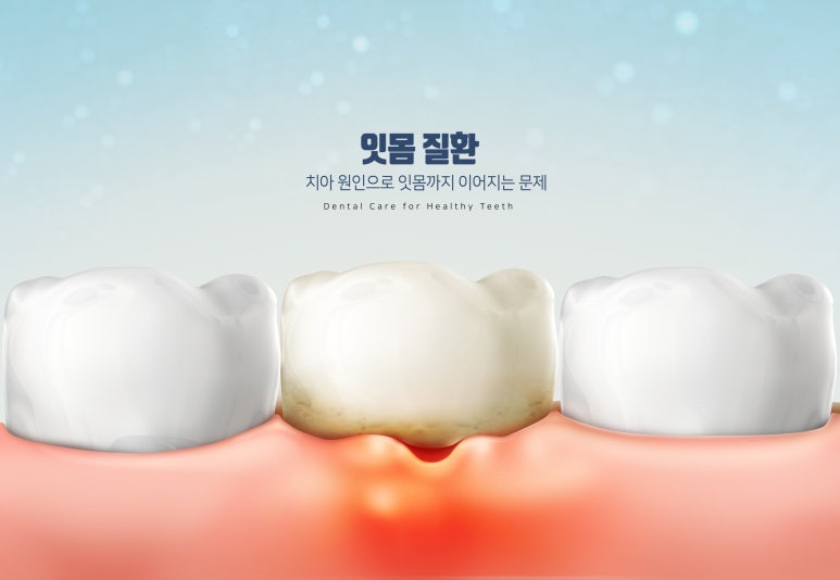 Why You Should Go to the Dentist Even When Your Teeth Don’t Hurt image 6