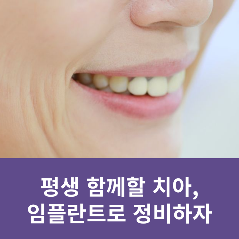 평생 함께할 치아, 임플란트로 정비하자 관련 이미지 10