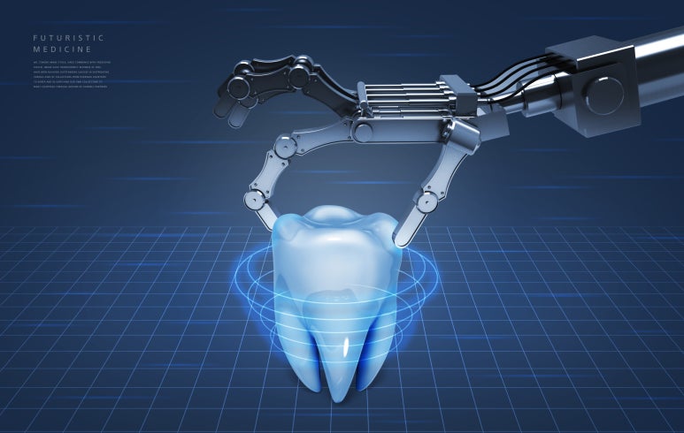 Are There Implants That Finish in One Day? image 5