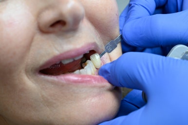 Custom Implants Tailored to the Patient's Situation image 4