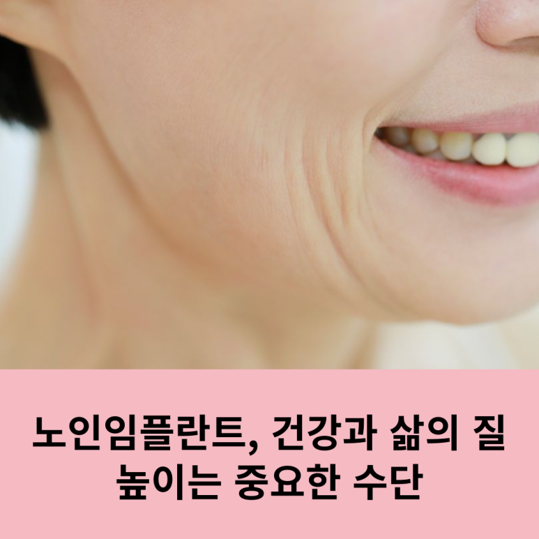 Senior Dental Implants: An Important Means of Improving Health and Quality of Life image 8