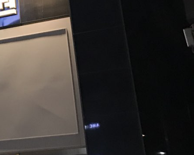 이가 빠졌을때, 임플란트 하세요 관련 이미지 22