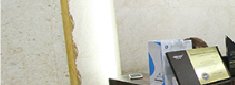 Regaining Youth with Full-Mouth Implants image 20