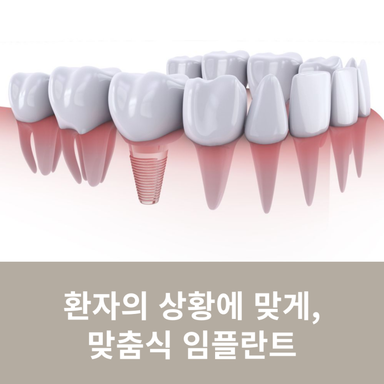 Custom Implants Tailored to the Patient's Situation image 9