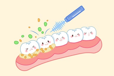 Implant Lifespan: Using It Longer with Proper Care image 5