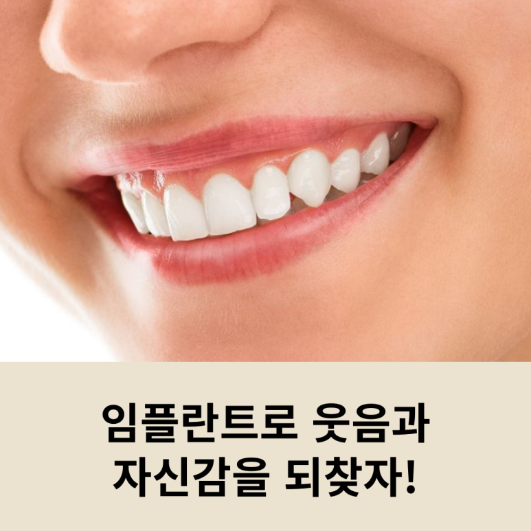 Let’s Regain Our Smile and Confidence with Implants! image 10
