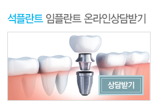 What Should You Check Before Getting an Implant Procedure? Seok Plant Explains. image 7