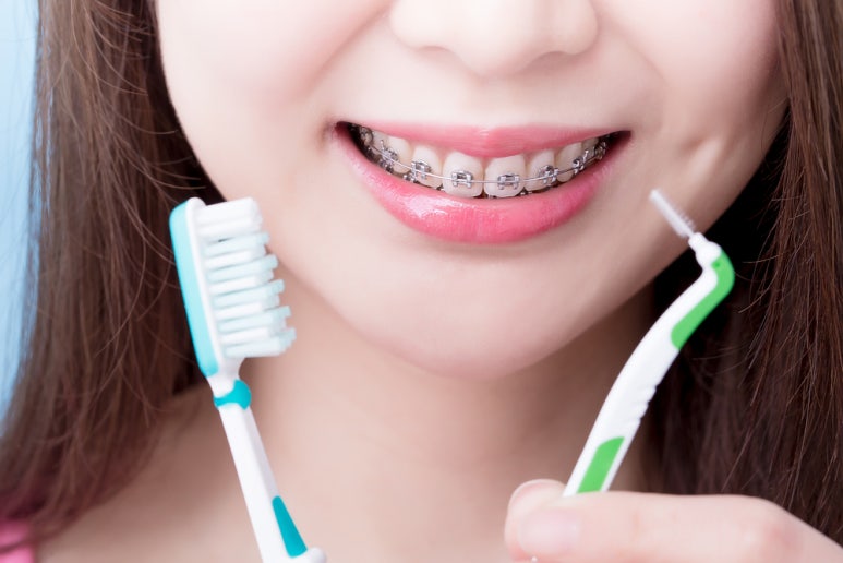 Post-Procedure Care for Implants Is as Important as the Procedure Itself image 5