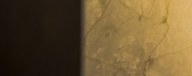 Implants: Treatment Timing and Aftercare Are Important! image 25