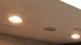 임플란트 치료기간에는 세심한 관리 필요 관련 이미지 11