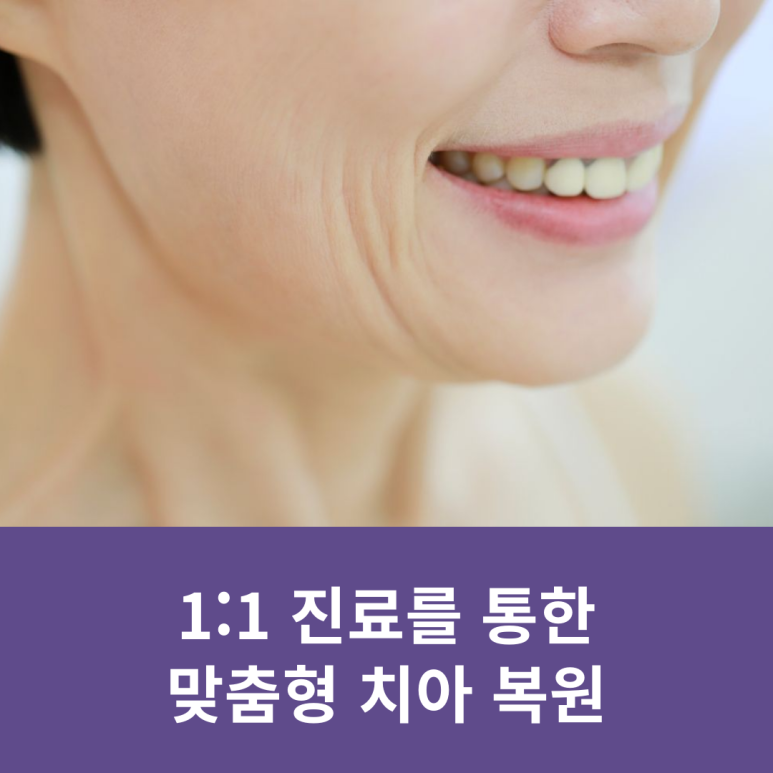 Personalized Tooth Restoration Through One-on-One Care image 6