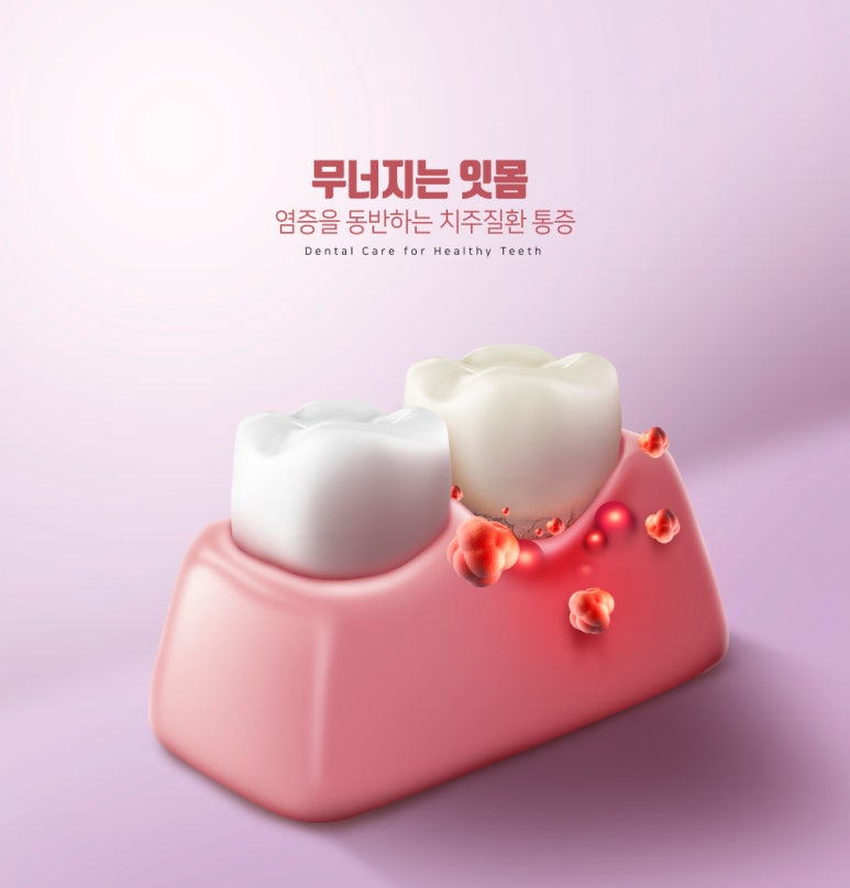 Why You Should Go to the Dentist Even When Your Teeth Don’t Hurt image 10