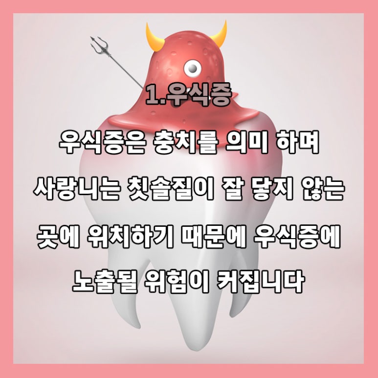 Dental Health Project with Seokplant - Is It Love, or a Wisdom Tooth? - image 5