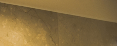 Implants: Treatment Timing and Aftercare Are Important! image 15