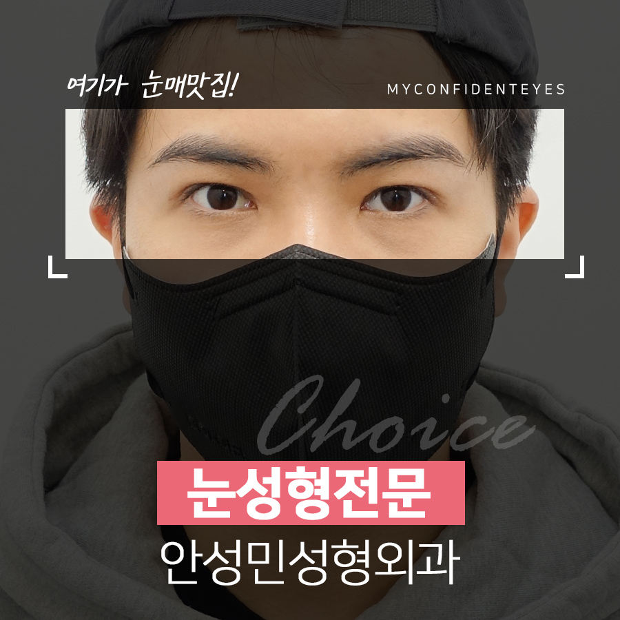 [잠실동성형외과] 원래 내 눈인듯 예쁜 눈.매.라.인! / 잠실성형외과 관련 이미지 1