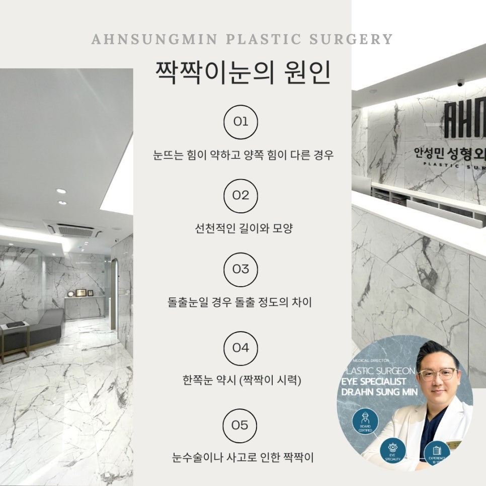 남자 돌출 눈 짝짝이 교정 잘하는 곳, 안검하수 짝짝이 안성민성형외과 관련 이미지 2
