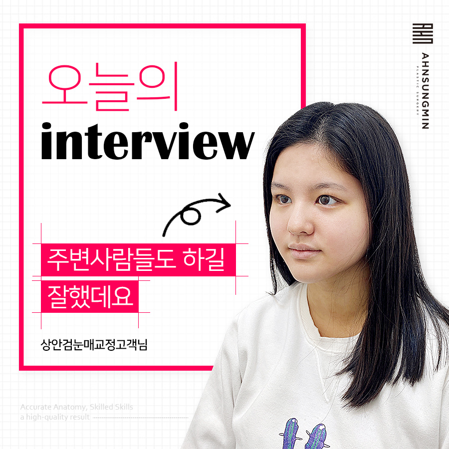 [잠실동성형외과] 상안검눈매교정 3개월차 후기 관련 이미지 1