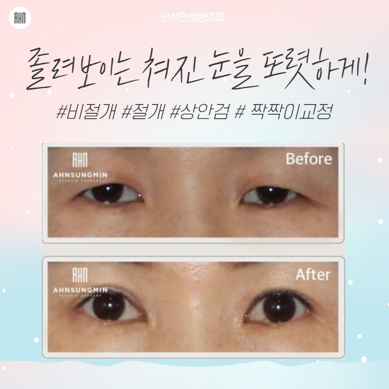 쌍수 어울림에 대한 기준을 세워 관련 이미지 10