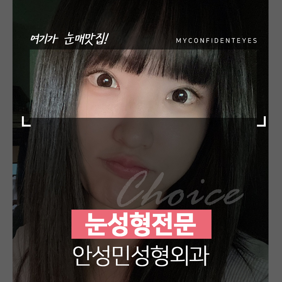 [잠실동성형외과] 이뻐지는 시간! 나를 위한 투자! 내맘에 드는 눈매라인 / 잠실소재 관련 이미지 1