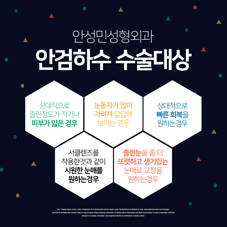 [잠실동성형외과] 졸려보이는눈! 답답해보이는눈! 안검하수란? 관련 이미지 1