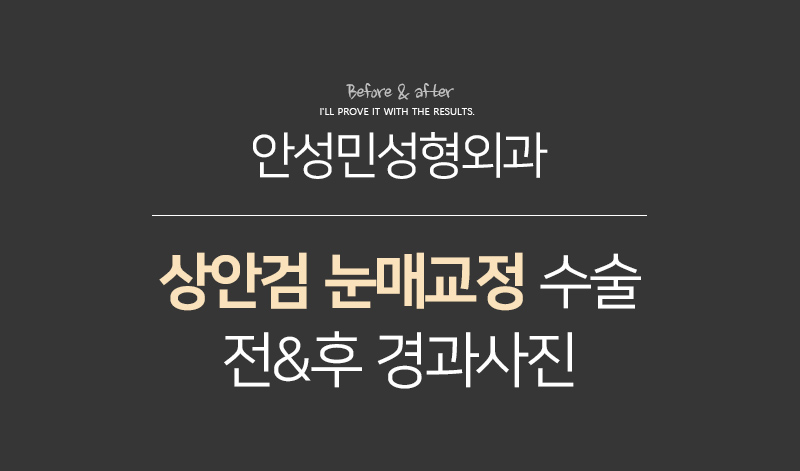 [잠실동성형외과] 결과로 증명하는 눈매교정 맛집! 매력적이게! 잠실성형외과 관련 이미지 2