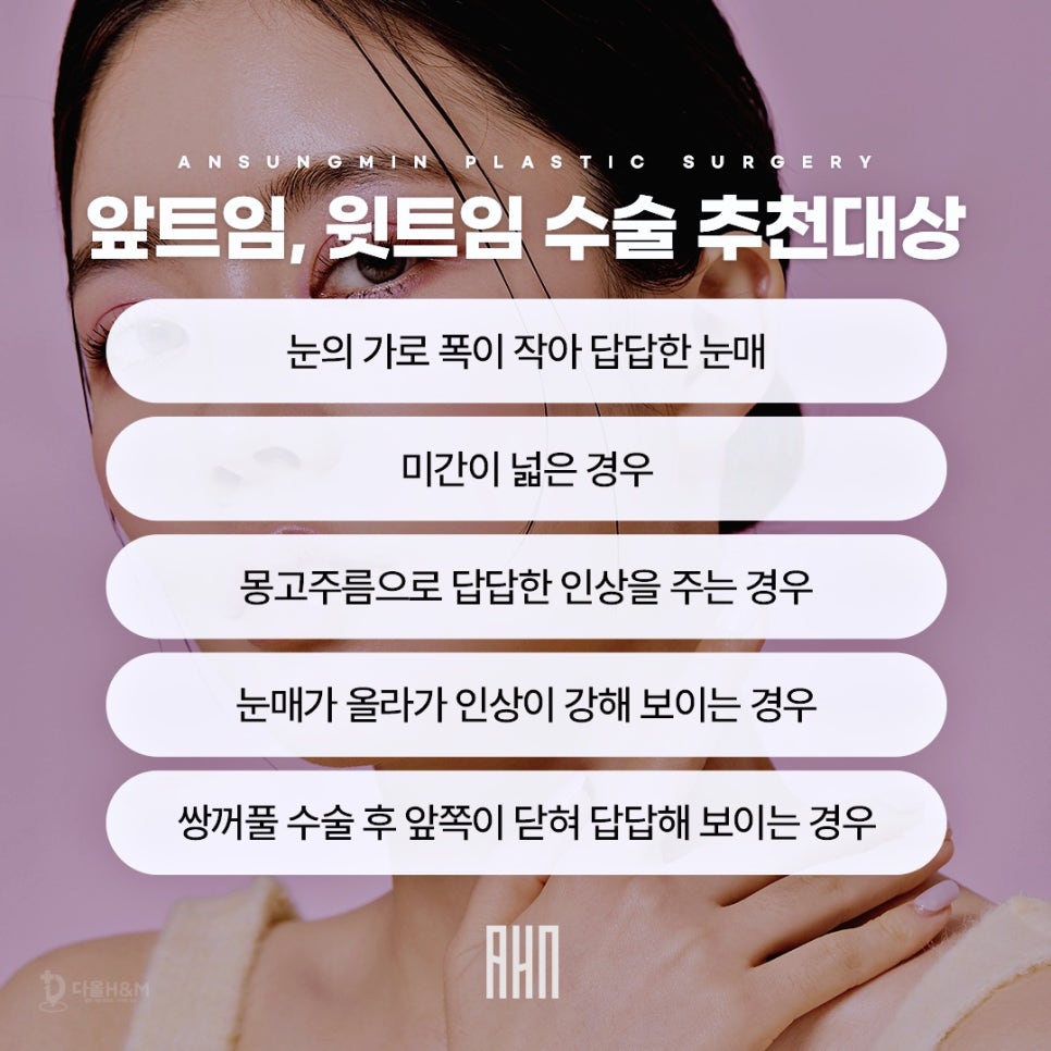 성형외과전문의 안성민이 말하는 트임수술 관련 이미지 5