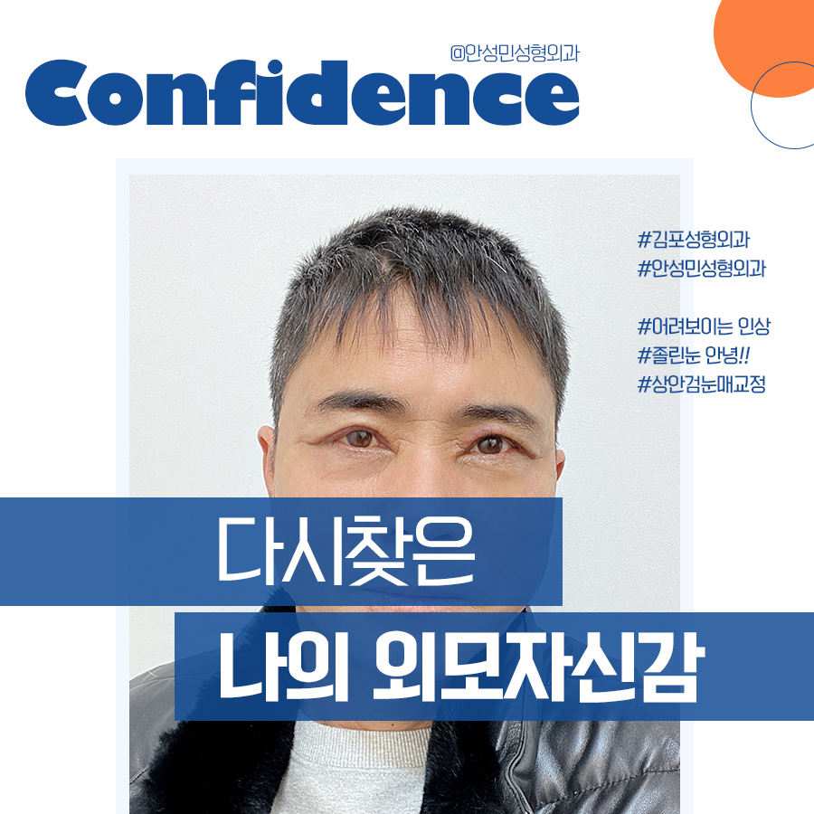[잠실동성형외과] 다시 찾은 나의 외모자신감! 어려보이는 인상으로 변신! / 잠실성형외과 관련 이미지 1