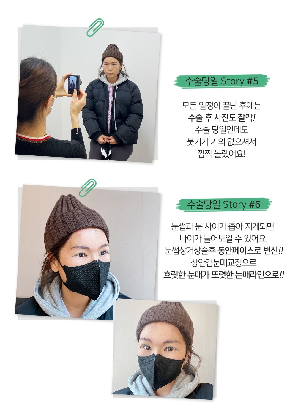 [잠실동성형외과] 고객님의 내원일상을 소개합니다~! 수술후기 / 성형리뷰 / 잠실성형외과 관련 이미지 3