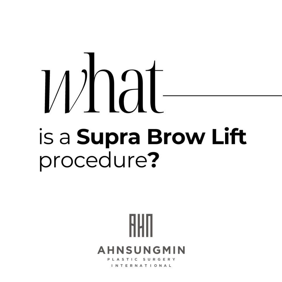 눈썹상거상 수술 전후 눈썹의 위치 관련 이미지 2