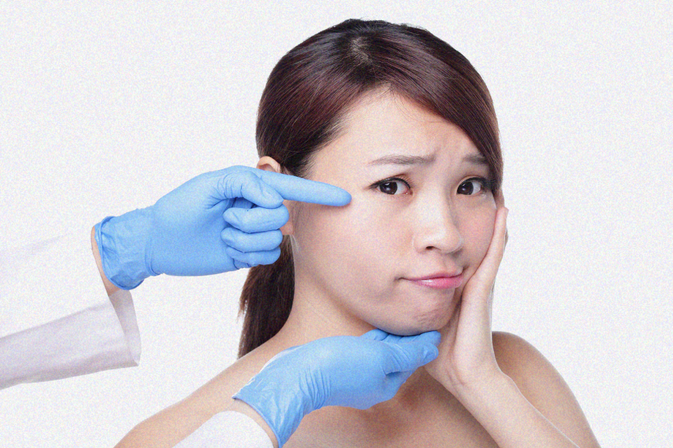 하안검수술비용 부작용이 고민이라면 관련 이미지 10