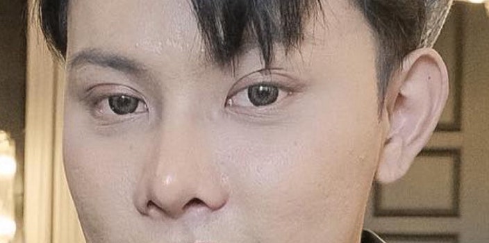 느끼한 남자 눈 무쌍이 되고 싶어요. 두꺼운 쌍꺼풀 낮추기 관련 이미지 3