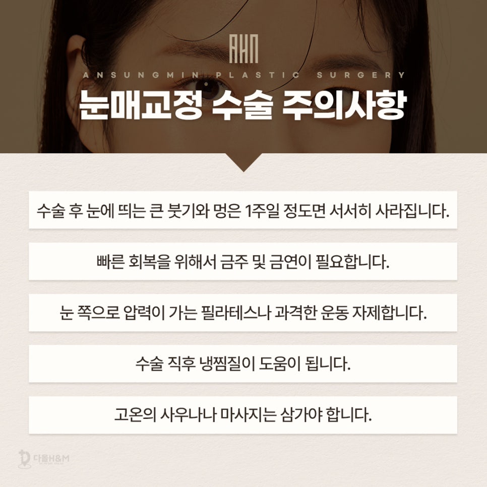 잠실성형외과, 눈매교정수술 잘하는 곳 관련 이미지 6